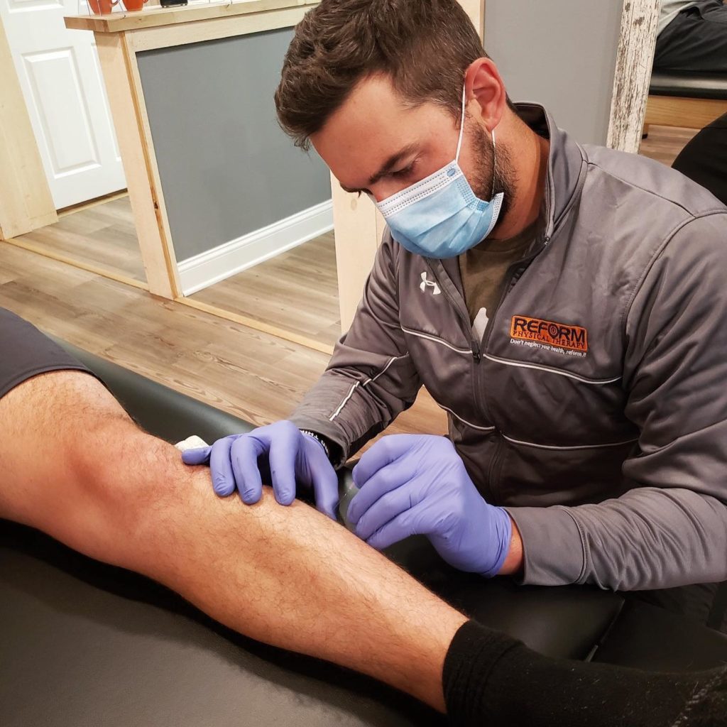 What is Dry Needling? Reform Physical Therapy
