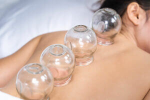 Cupping therapy along woman's spine