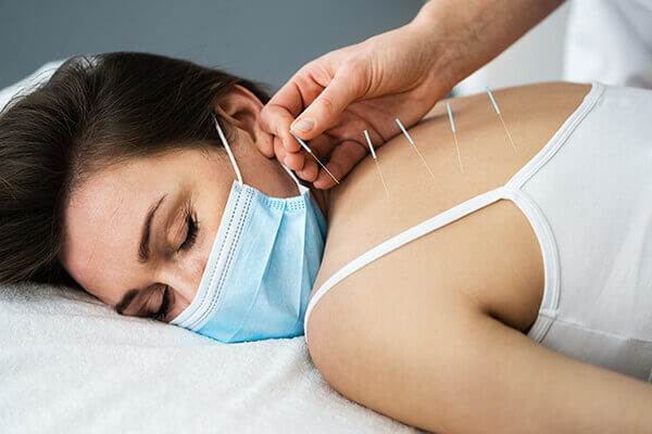 Woman receiving Dry Needle therapy